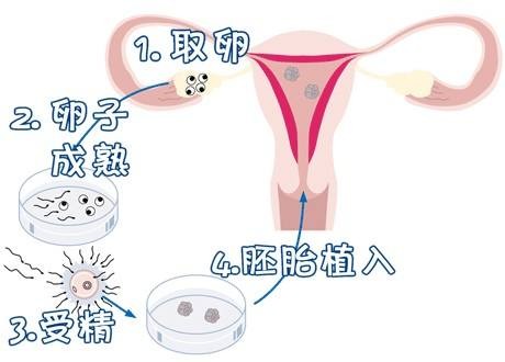 好韵多次失败疑难中心
